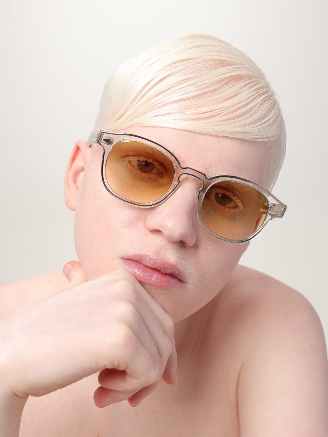 MOSCOT OCCHIALI DA SOLE: Occhiali da sole in acetato Moscot, Trasparente - Img 2